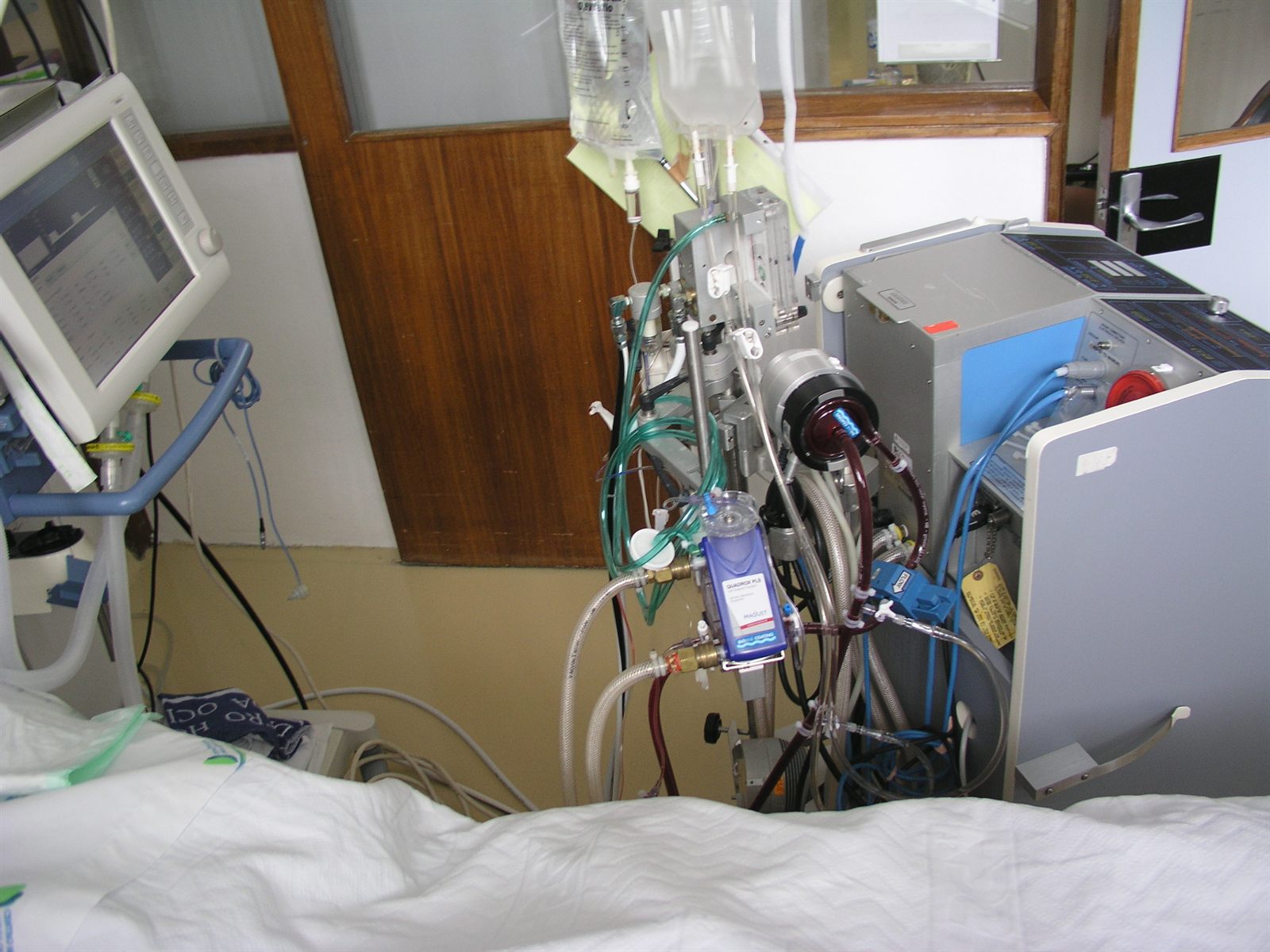 ECMO console with centrifugal pump and oxygenator in an ICU